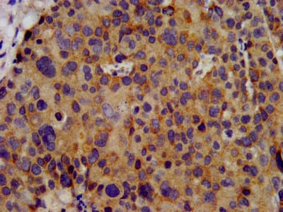 Polyclonal Rabbit anti-Human KCNC3 / Kv3.3 Antibody (IHC, IF)