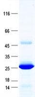 Human ZNF673 Protein (Recombinant His, N-Terminal)