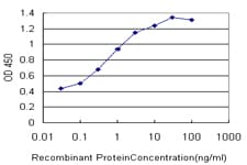 Monoclonal Mouse anti-Human FOXA1 Antibody (clone 1B1, IHC, IF, WB)