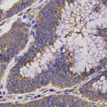 Polyclonal Rabbit anti-Human EPHX2 / Epoxide Hydrolase 2 Antibody (IHC, WB)