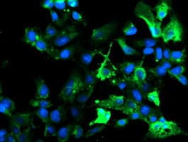 RPN1 / Ribophorin I Antibody (clone OTI5B1, Carrier-free)