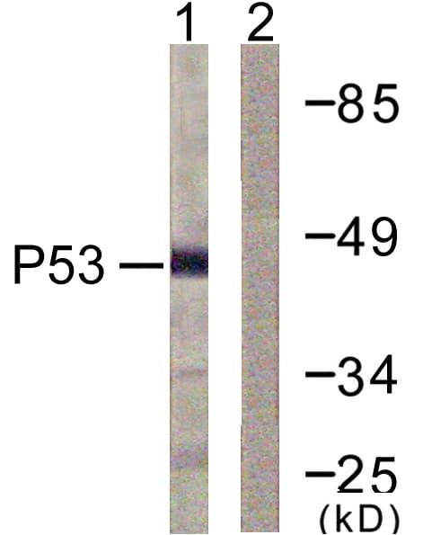 Polyclonal Rabbit anti-Human TP53 / p53 Antibody (aa336-385, WB)