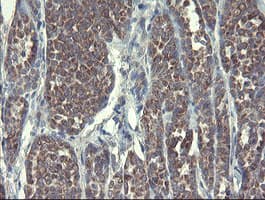 DPH2 Antibody (clone OTI3A12)