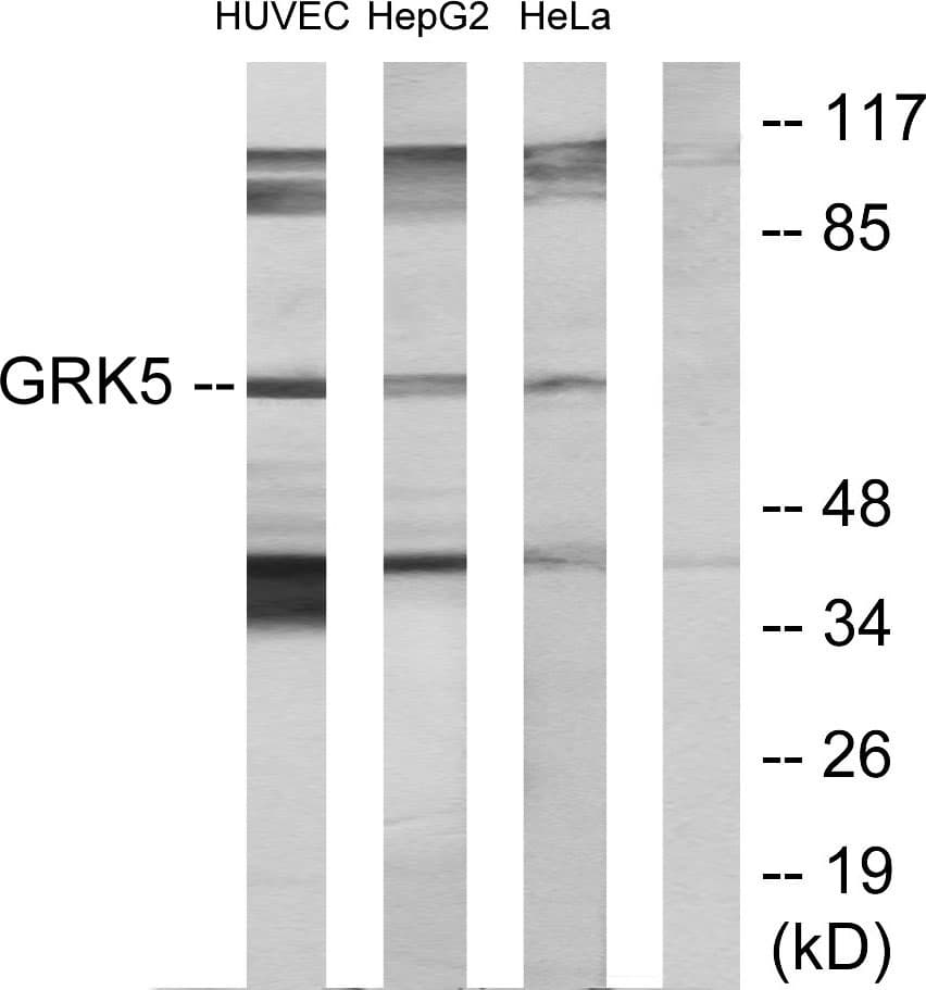 GRK5 Antibody (aa351-400)