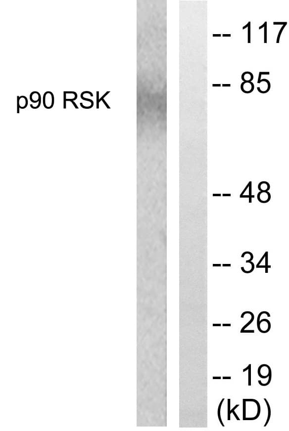 IHC-plus™ RPS6KA1 / RSK1 Antibody (aa346-395)