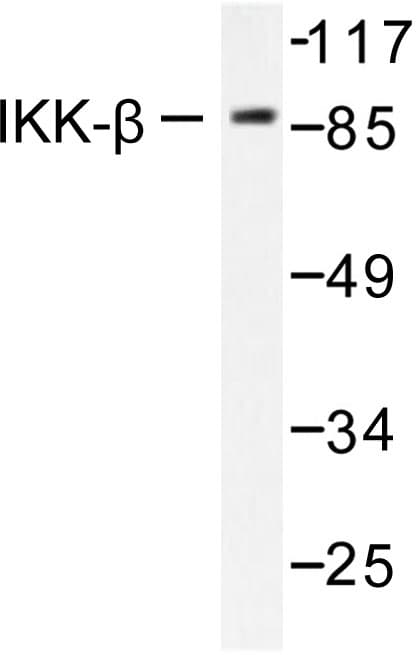 IKBKB / IKK2 / IKK Beta Antibody (Phe182)