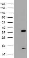 PDLIM2 / SLIM Antibody (clone OTI3B5)