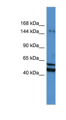 ZMYM3 Antibody (N-Terminus)