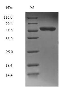 Human MAPK8 / JNK1 Protein (Recombinant 6His, N-terminus)