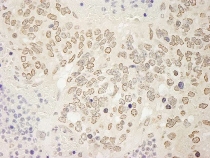 USP15 Antibody (aa960-C-term)