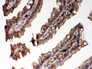 HLA-C Antibody