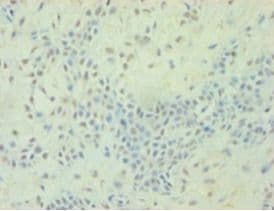 TGFB2 / TGF Beta2 Antibody (aa304-413, Biotin)