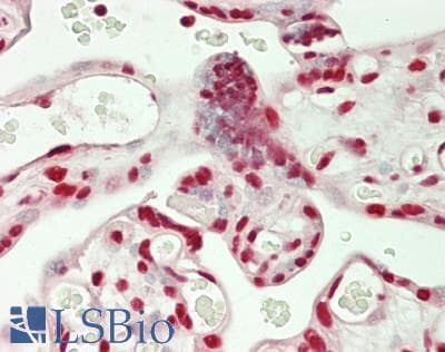 IHC-plus™ Polyclonal Rabbit anti-Human SF3B130 / SF3B3 Antibody (aa1167-1217, IHC, WB)