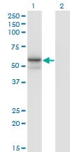Alpha Fucosidase / FUCA1 Antibody (clone 1D4)
