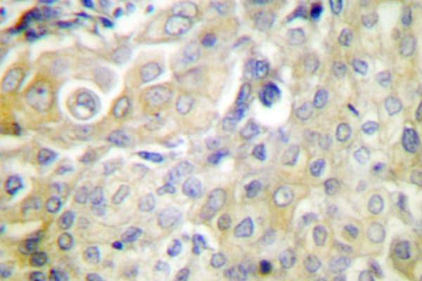 SERPINB5 / Maspin Antibody (Thr118)
