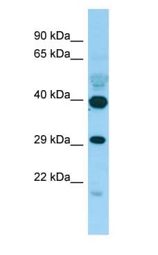 Polyclonal Rabbit anti-Human DJ858B16.2 / PISD Antibody (aa189-238, WB)