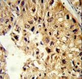 PCBD1 / PHS Antibody (aa11-37)
