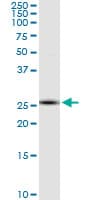 RNF170 Antibody (clone 2D6)