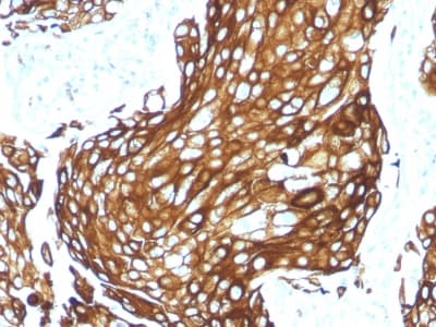 KRT77 / Keratin 77 / KRT1B Antibody (clone KRTL/1577R)