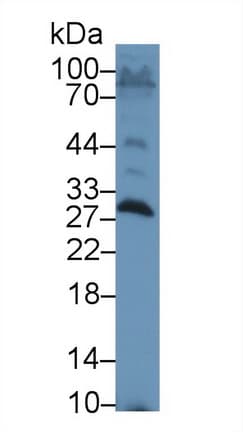 APCS / Serum Amyloid P / SAP Antibody (aa22-222)