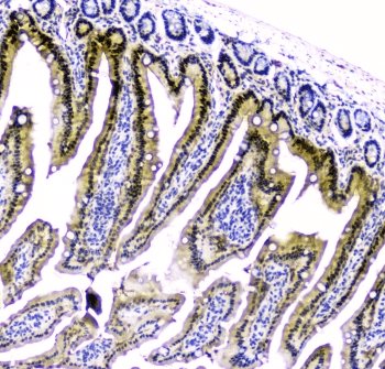Polyclonal Rabbit anti-Human CDA / Cytidine Deaminase Antibody (IHC, WB)