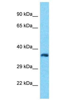 Polyclonal Rabbit anti-Human ROGDI Antibody (aa27-76, WB)