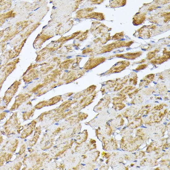 ANT2 / SLC25A5 Antibody