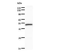Monoclonal Mouse anti-Human SATB1 Antibody (clone 3548D4_2a, IF, WB)
