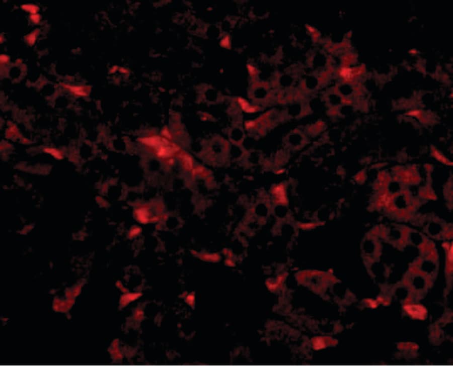IHC-plus™ GNPDA2 Antibody