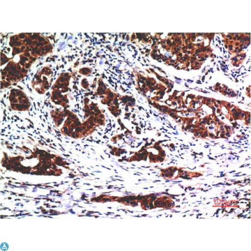 AKT1 Antibody