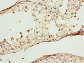 WIPI2 Antibody