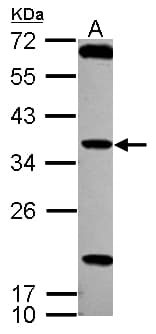 TSSK4 / TSSK5 Antibody