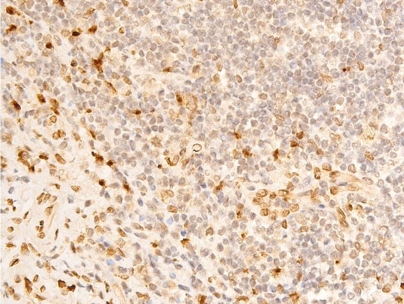 LMNA / Lamin A+C Antibody (phospho-Ser392)