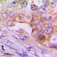 CASP6 / Caspase 6 Antibody (Internal)