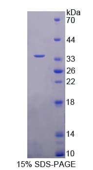 Human NEIL1 Protein (Recombinant His-T7)