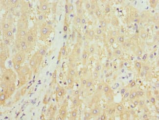 HGD Antibody