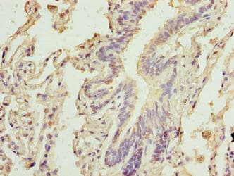 CAPN6 / Calpain 6 Antibody
