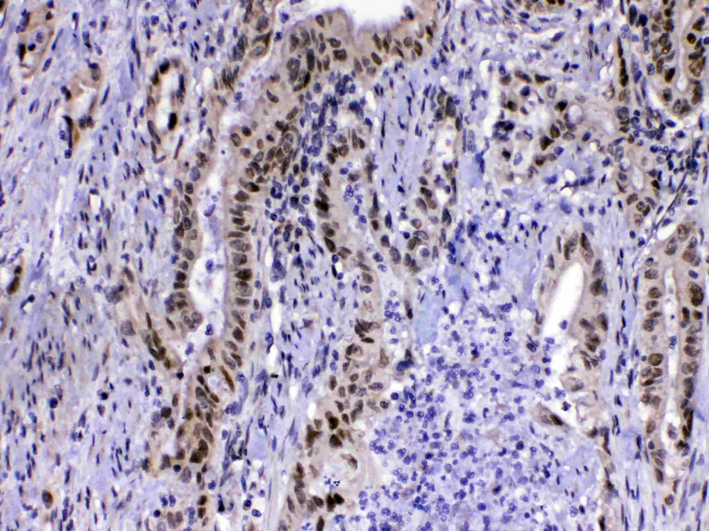 MED15 / ARC105 Antibody
