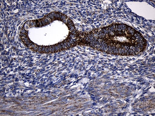 PCCA Antibody (clone OTI1E9)