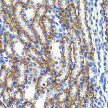 ZFAND3 / TEX27 Antibody