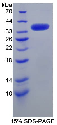 Human SRPK3 / MSSK1 Protein (Recombinant His-T7)