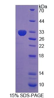 Rat PIDD1 Protein (Recombinant His-T7)
