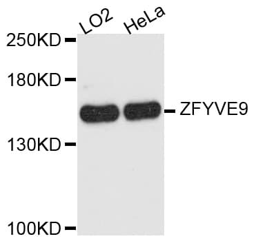Polyclonal Rabbit anti-Human ZFYVE9 / SARA Antibody (WB)