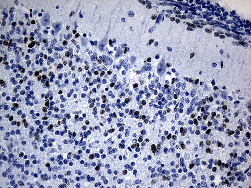 PHF20L1 Antibody (clone OTI1F4)