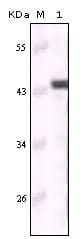 IHC-plus™ KRT5 / CK5 / Cytokeratin 5 Antibody (clone 3E2F1)