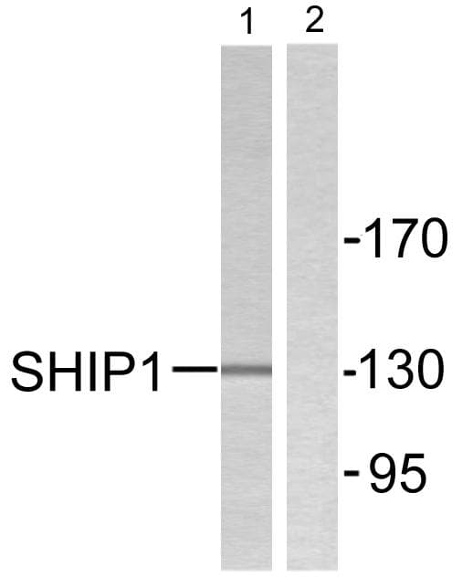 INPP5D / SHIP1 / SHIP Antibody (p1020)