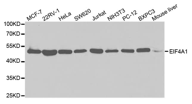 Polyclonal Rabbit anti-Human EIF4A1 Antibody (IF, WB)
