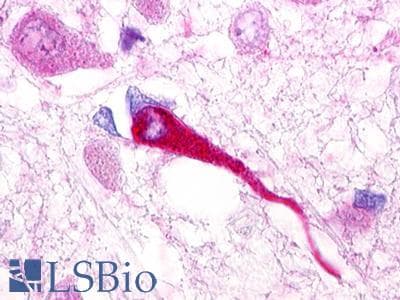 PathPlus™ GALR1 / Galanin Receptor 1 Antibody (Extracellular Domain)
