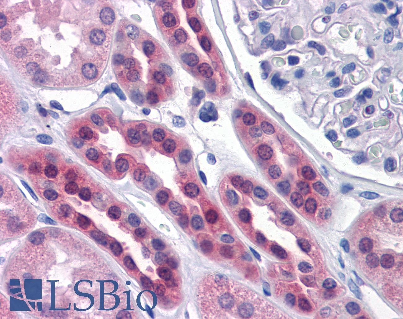 IHC-plus™ SDSL / Serine Dehydratase-Like Antibody (clone M2)