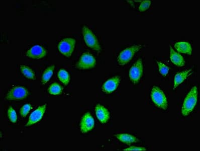 Polyclonal Rabbit anti-Human MLANA / Melan-A Antibody (aa48-118, IHC)